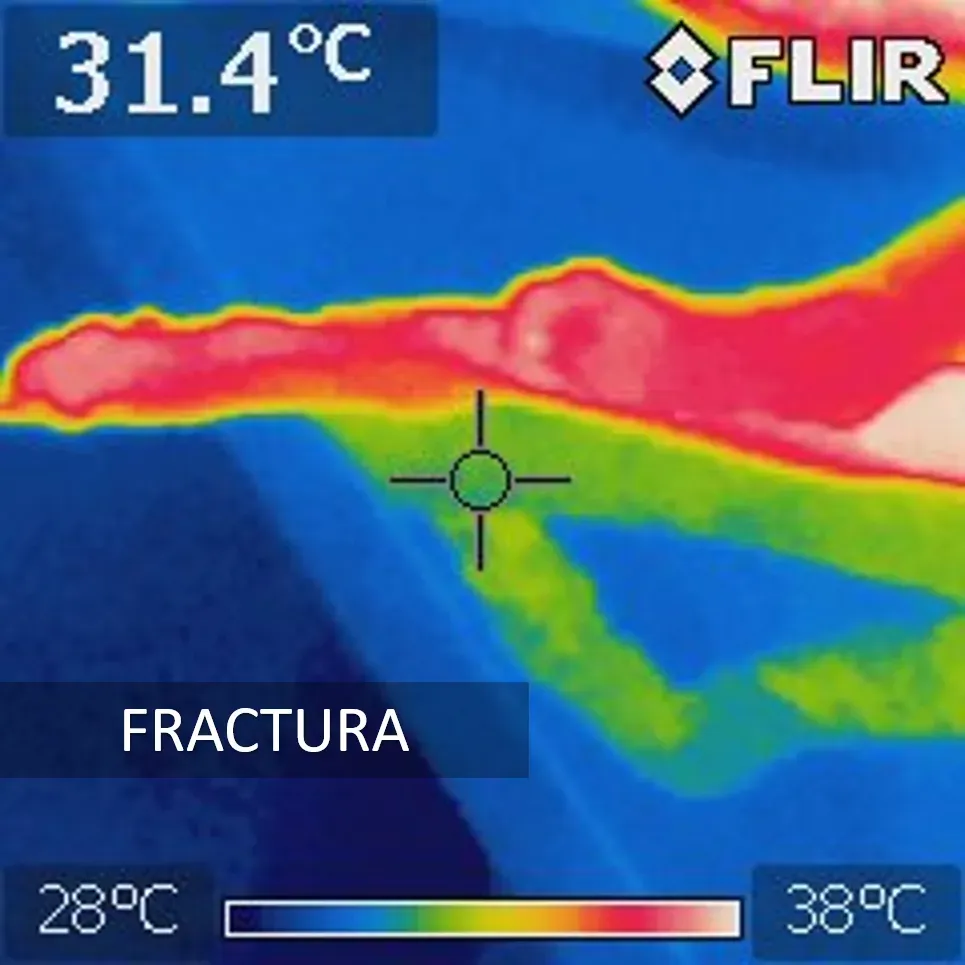 Endoscopios / Camara térmica